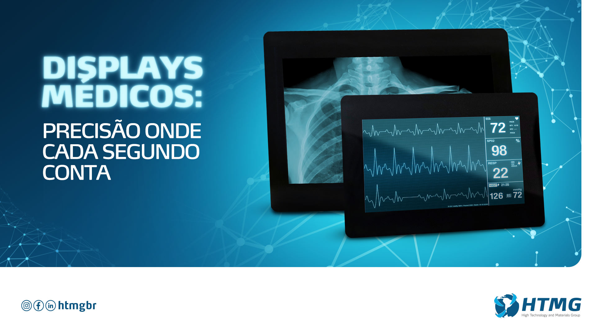 Displays médicos: precisão onde cada segundo conta